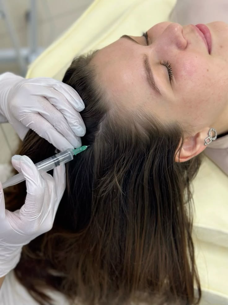 Mesoterapia Capilar